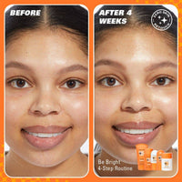 Revolution Skincare Be Bright Starter Kit