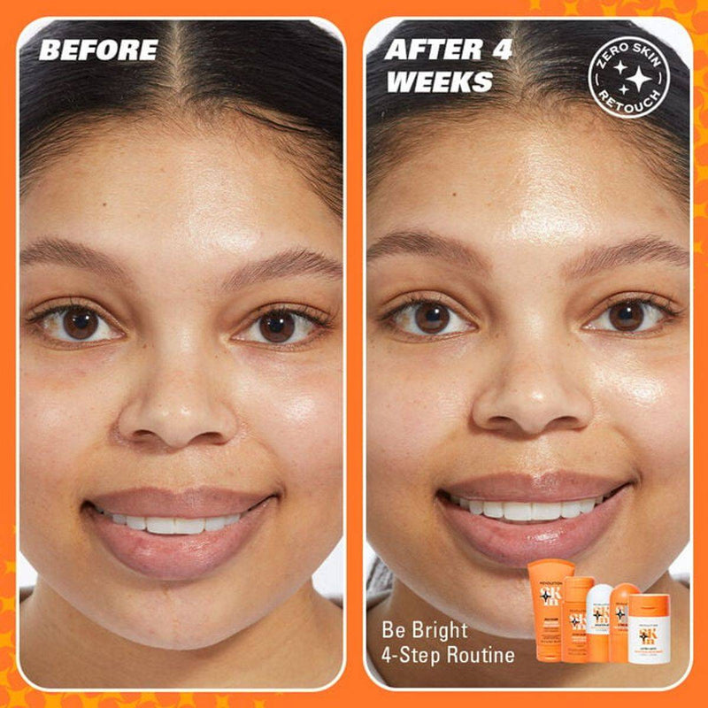 Revolution Skincare Be Bright Starter Kit