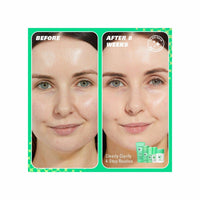 Revolution Skincare Clearly Clarify Starter Kit