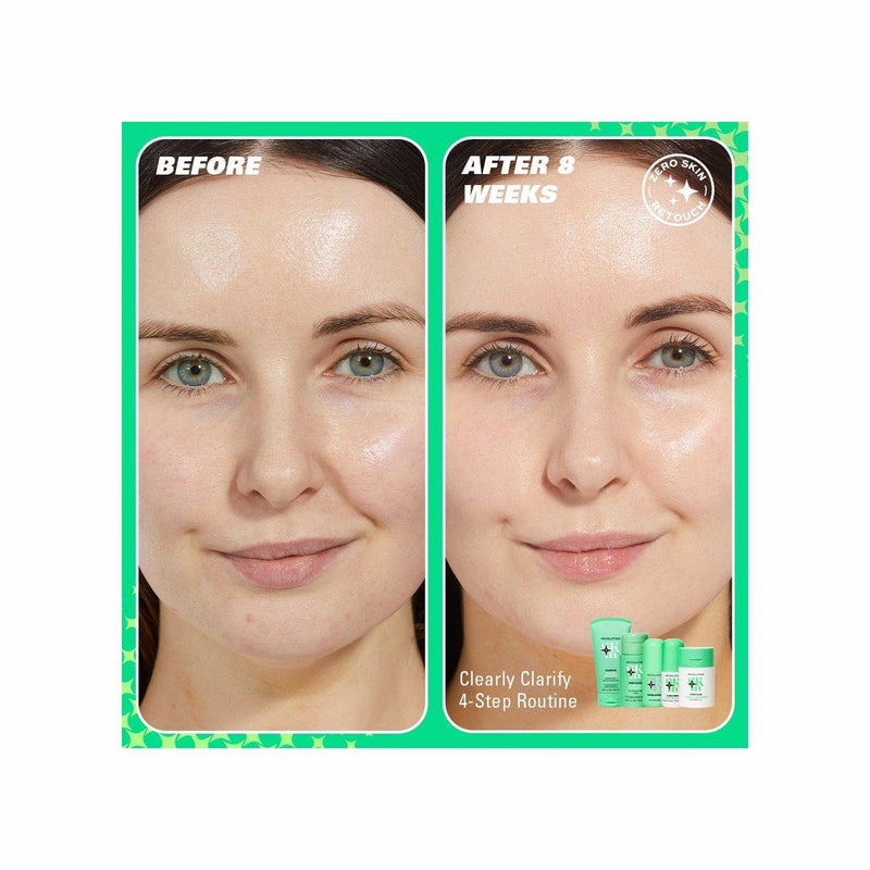 Revolution Skincare Clearly Clarify Starter Kit