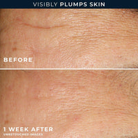 RoC Multi Correxion Hydrate & Plump Serum 30 Capsules