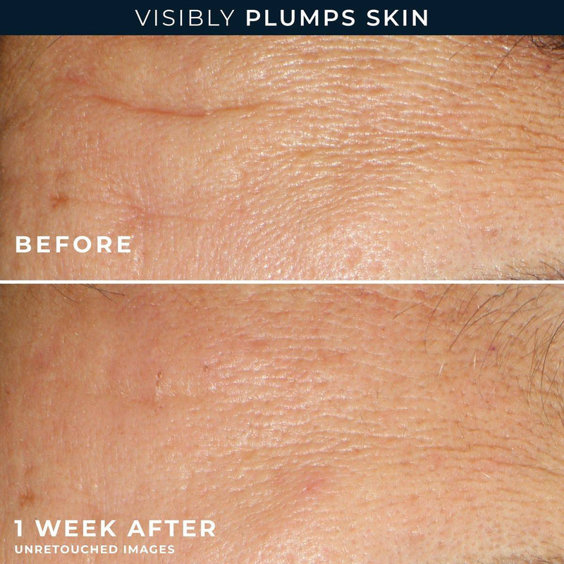 RoC Multi Correxion Hydrate & Plump Serum 30 Capsules