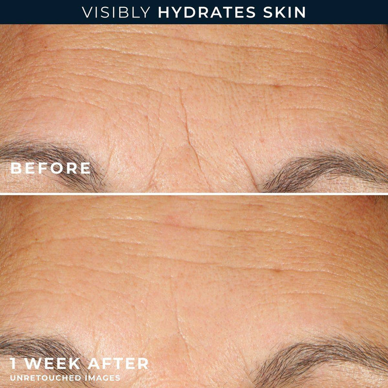 RoC Multi Correxion Hydrate & Plump Serum 30 Capsules