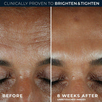 RoC Multi Correxion Revive & Glow Daily Serum 30ml