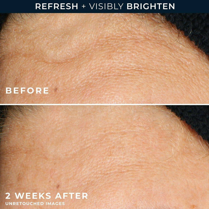 RoC Multi Correxion Revive & Glow Gel Cleanser 177ml