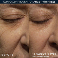 RoC Retinol Correxion Wrinkle Correct Night Cream 30ml