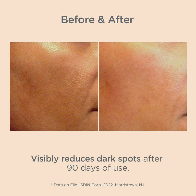 Isdin Isdinceutics Brighten Melaclear Serum 15ml