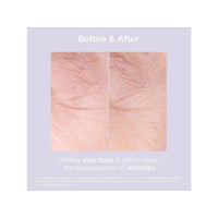 Isdin Isdinceutics Renew Glicoisdin 15 Moderate Facial Gel 50g