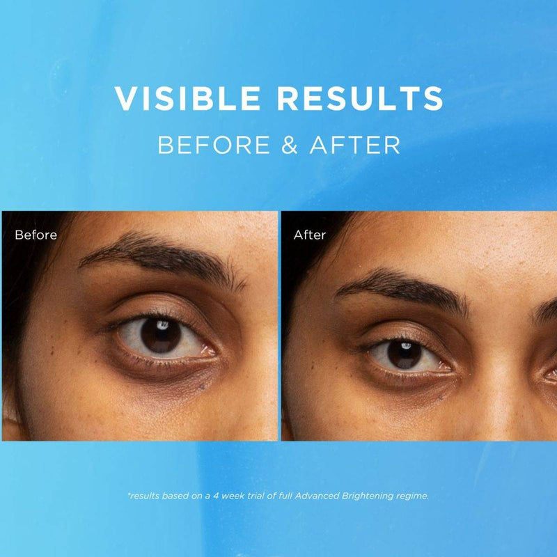 Fadeout Advanced Whitening Eye Defence Cream SPF25 15ml