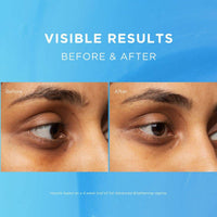 Fadeout Advanced Whitening Eye Defence Cream SPF25 15ml