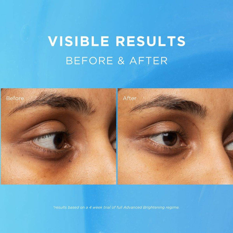 Fadeout Advanced Whitening Eye Defence Cream SPF25 15ml