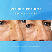 Fadeout Advanced Whitening Night Cream 50ml