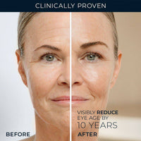RoC Retinol Correxion Line Smoothing Eye Cream 15ml