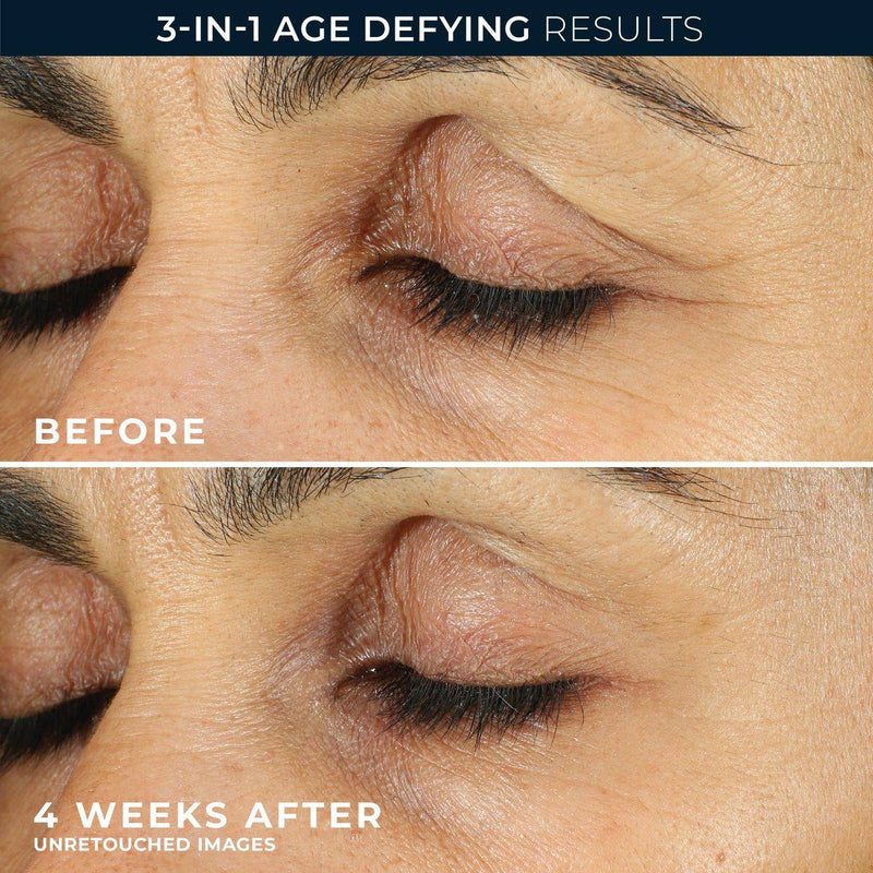 RoC Retinol Correxion Line Smoothing Eye Cream 15ml