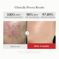 Medicube Red Succinic Acid Peeling 70 Pads