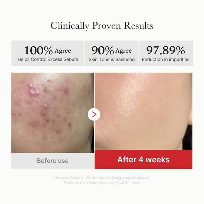 Medicube Red Succinic Acid Peeling 70 Pads