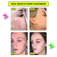Carbon Theory Zap Supacylic 2% Salicylic Acid Serum 30ml