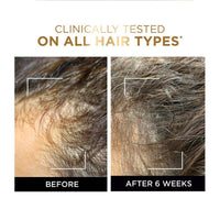 Loreal Paris Elvive Fall Resist Serum 102ml