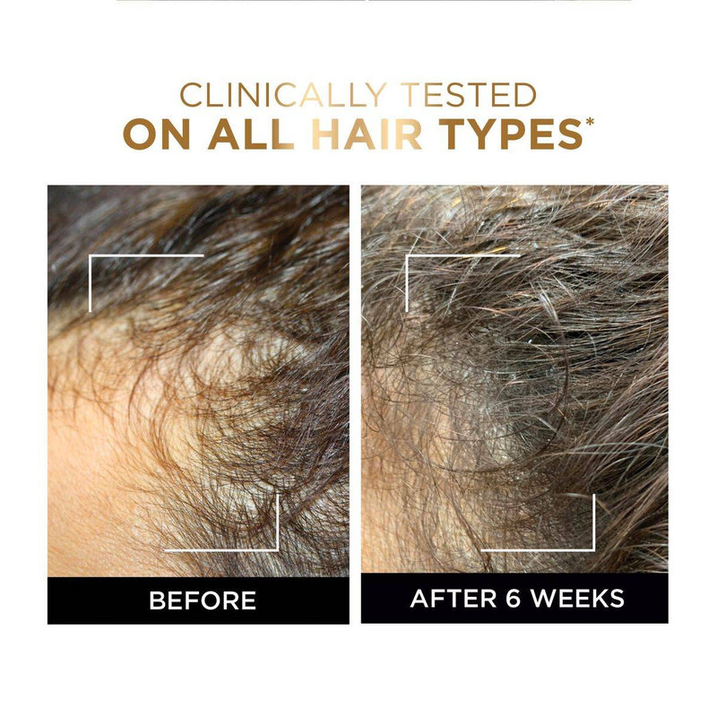 Loreal Paris Elvive Fall Resist Serum 102ml