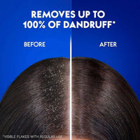 Head & Shoulders Anti Dandruff Charcoal Detox Shampoo 400ml