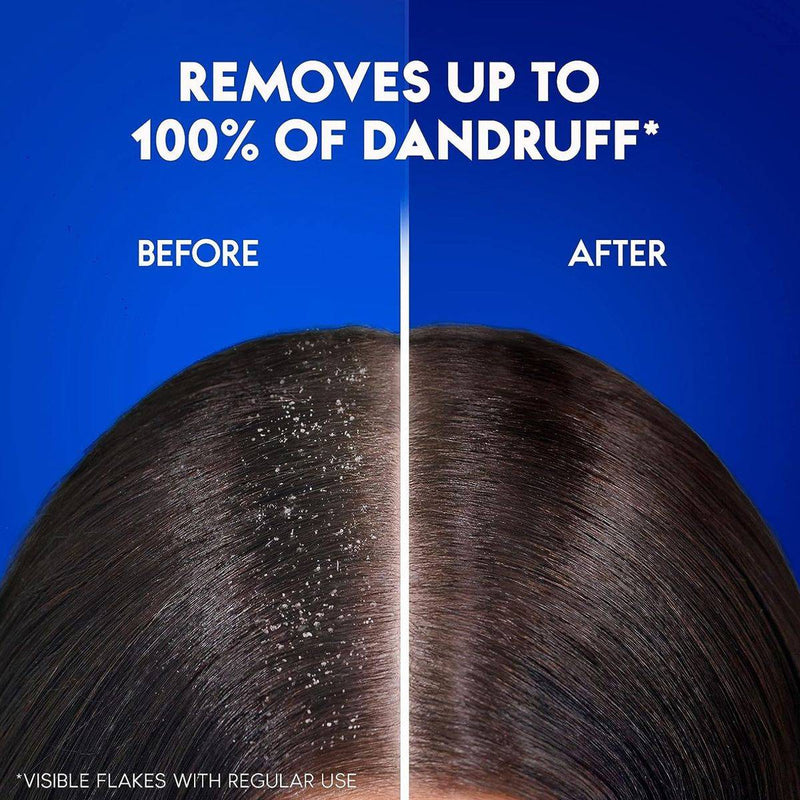 Head & Shoulders Anti Dandruff Charcoal Detox Shampoo 400ml