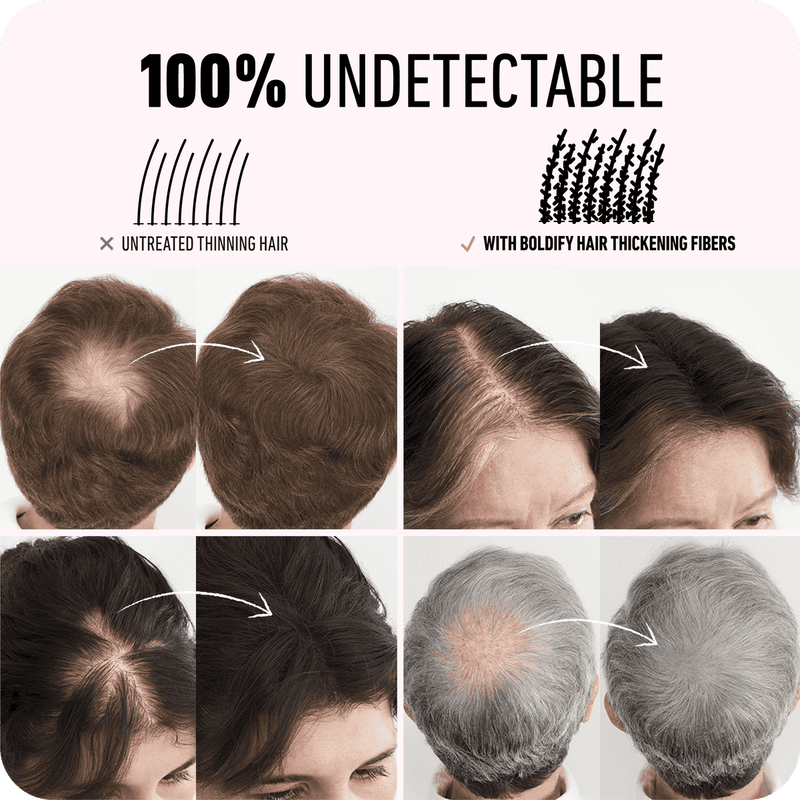 Boldify Hair Building Fiber Dark Brown 12g