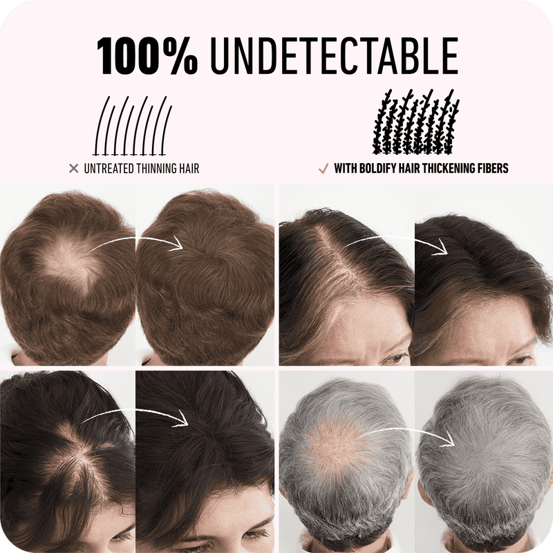 Boldify Hair Building Fiber Dark Brown 28g