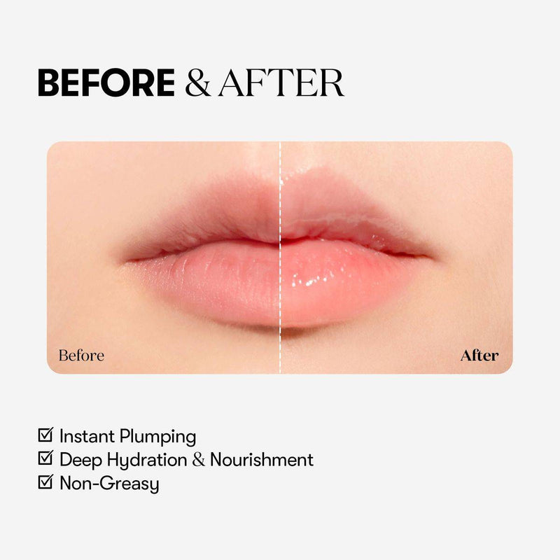 VT Cosmetics Reedle Shot Lip Plumper Beginner 4.3g
