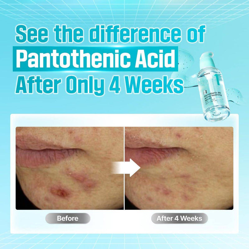 Numbuzin 1 Pantothenic B5 Active Soothing Serum 50ml