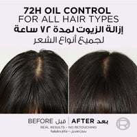 Loreal Paris Elvive Hyaluron Pure Shampoo 400ml