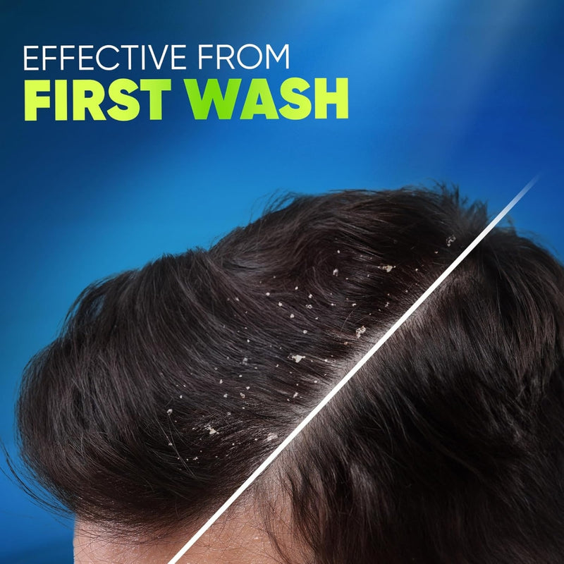 Head & Shoulders Anti Dandruff Deep Clean Severe Oily Scalp Shampoo 400ml