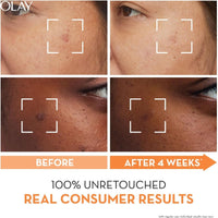 Olay Luminous Niacinamide + Vitamin C Cream 50g
