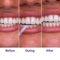 Hismile Glostik Tooth Gloss 4ml