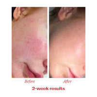 Trilogy Vitamin C Booster Treatment 15ml