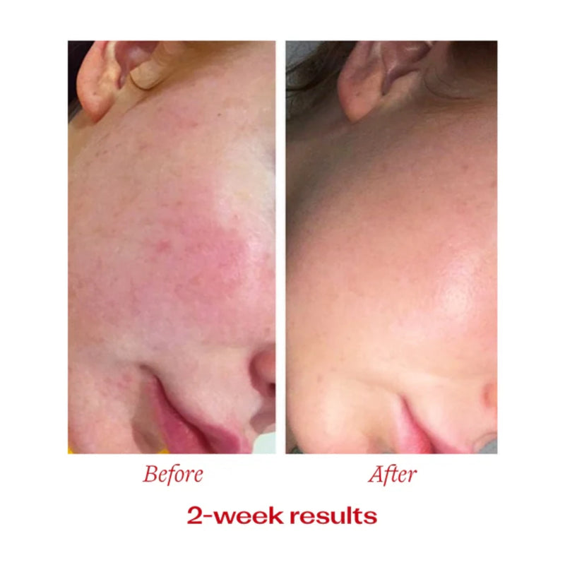 Trilogy Vitamin C Booster Treatment 15ml