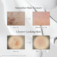 VT Cosmetics Reedle Shot 700 Cica Reedle 30ml