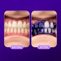 Hismile V34 Teeth Whitening Colour Corrector Toothpaste 30ml