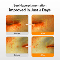 Abib Glutathiosome Dark Spot Vita Drop Serum 50ml