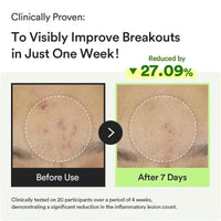 Abib Heartleaf Teca Capsule Calming Drop Serum 50ml