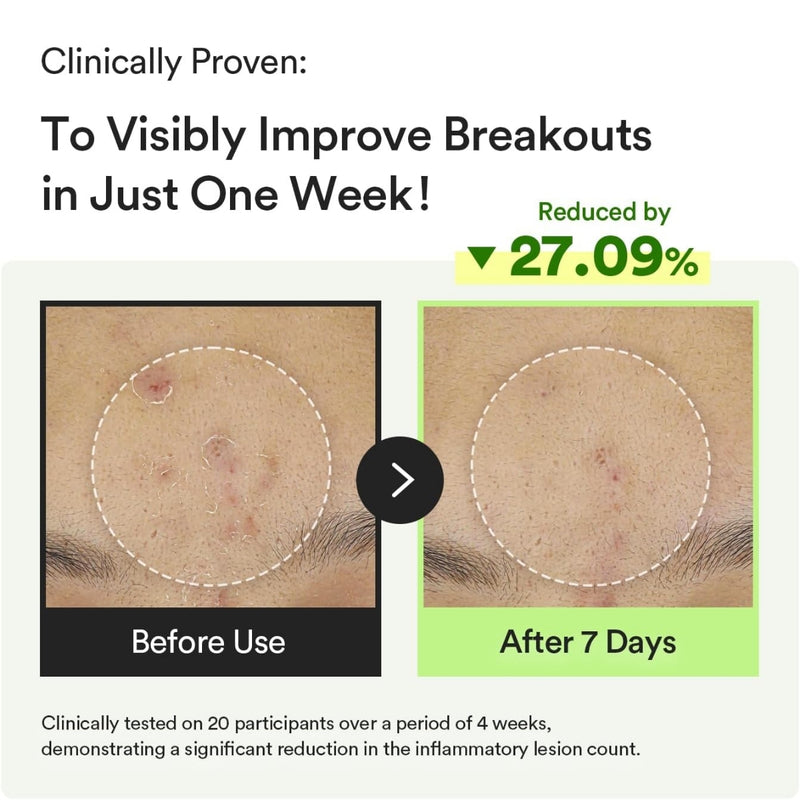 Abib Heartleaf Teca Capsule Calming Drop Serum 50ml