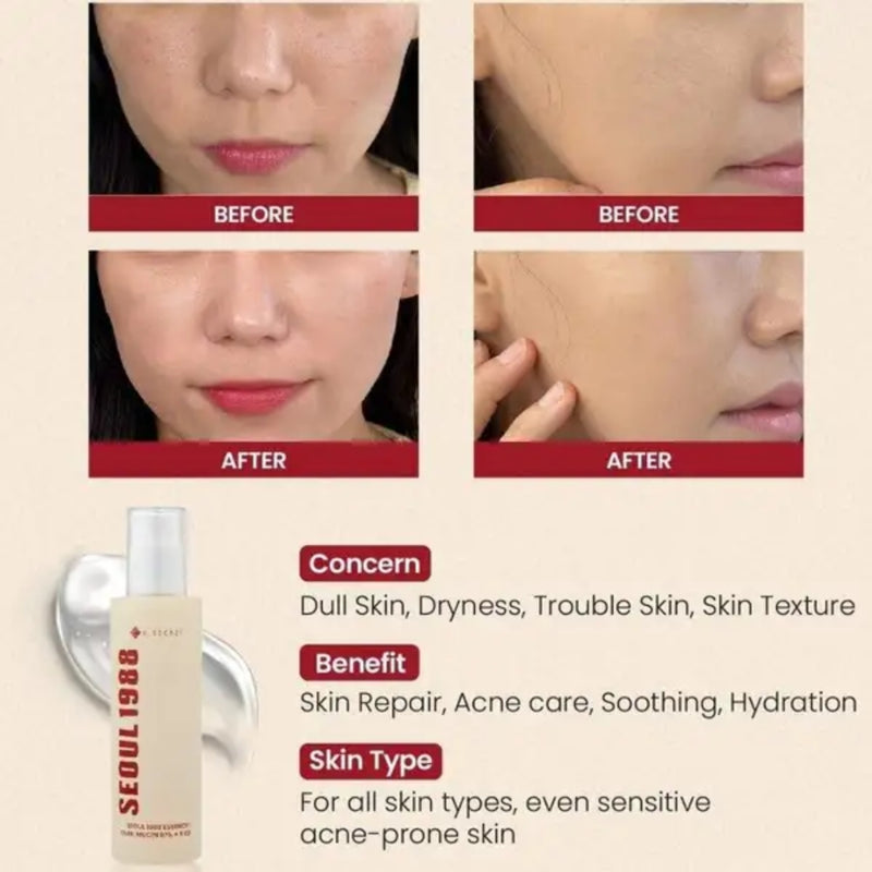 K-Secret Seoul 1988 Essence : Snail Mucin 97% + Rice 100ml