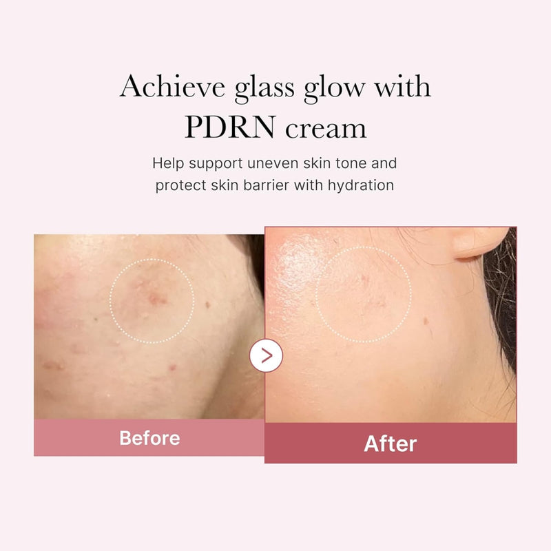 Medicube PDRN Pink Peptide Hyaluronic Cream 50ml
