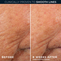 RoC Retinol Correxion Line Smoothing Night Serum 30 Capsules