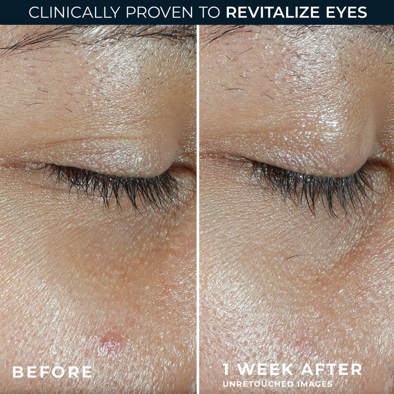 RoC Multi Correxion Revive + Glow Eye Balm 4g