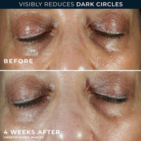 RoC Multi Correxion Even Tone + Lift Eye Cream 15ml