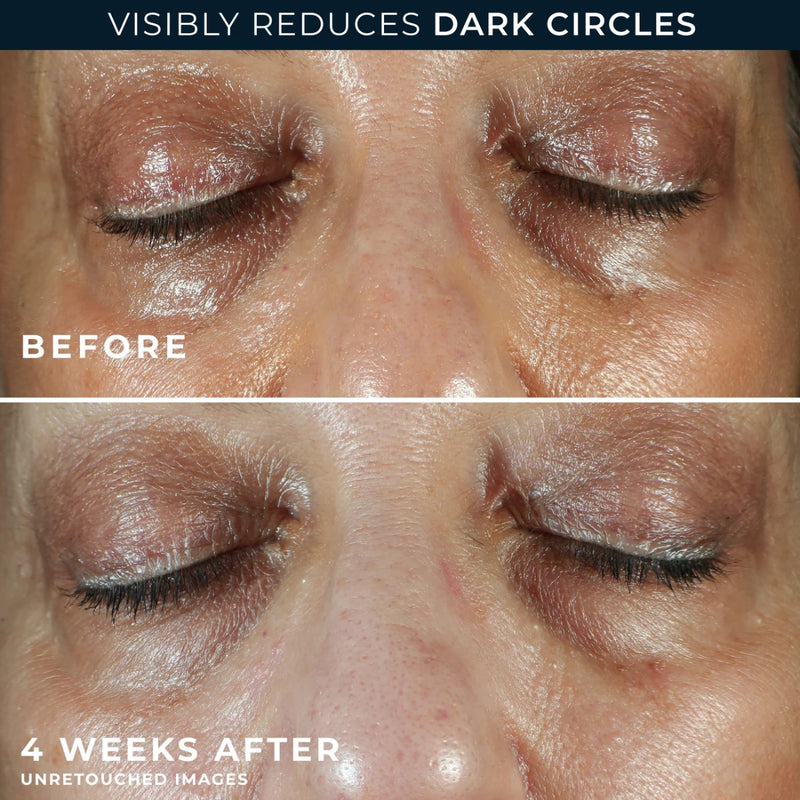 RoC Multi Correxion Even Tone + Lift Eye Cream 15ml