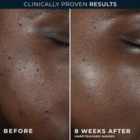 RoC Multi Correxion Even Tone + Lift Night Cream 50ml