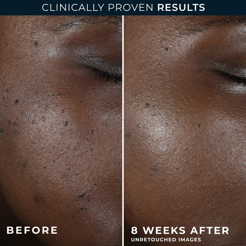 RoC Multi Correxion Even Tone + Lift Night Cream 50ml