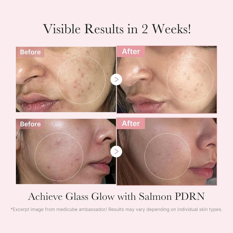 Medicube PDRN Pink Glow Kit