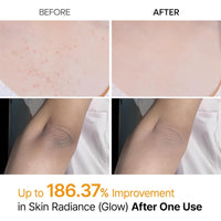 Dr. Melaxin Peel Shot Exfoliating Kojic Acid Turmeric Spray 200ml